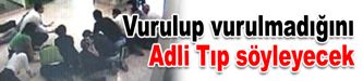 Vurulup vurulmadığını Adli Tıp söyleyecek