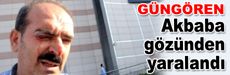 Gazeteci Akbaba gözünden yaralandı
