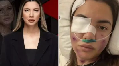 Fulya Öztürk Hakkındaki Kaza İddiası Yalanlandı