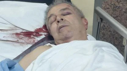 Şirinevler’de kavga: 67 yaşındaki sürücü yoğun bakımda