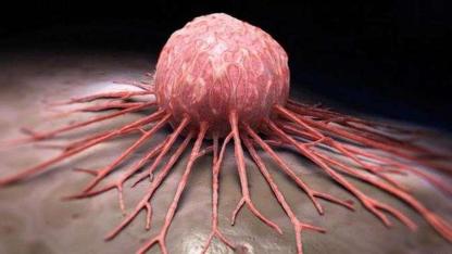 Kanserin genetik haritası çıkarıldı: 448 türde yeni dönem